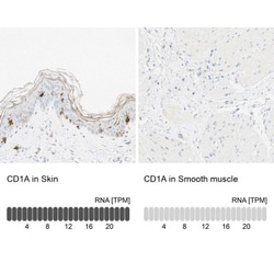 CD1a Antibody, Novus Biologicals 0.1mL; Unlabeled:Antibodies, Polyclonal